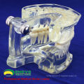 DENTAL11 (12571) Humano Adulto Natural Tamanho Transparente Padrão Dental Ensinar Modelos